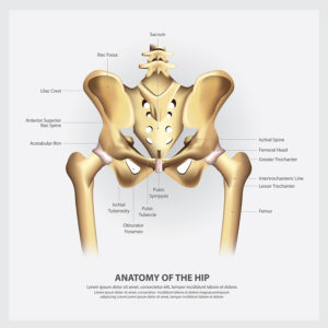 Hip surgery, hip replacement, Dr. Clohisy